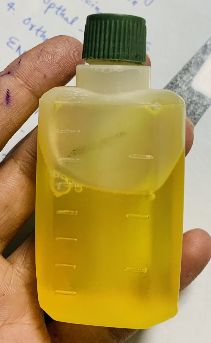 DrMann1995's tweet photo. 1 year child with History of Fever &amp; dry cough since 1 day . No other symptoms. 
These are the Medicine prescribed by an Ayurvedic Doctor. I am again requesting BAMS doctors not to prescribe Steroids &amp; antibiotics unnecessarily 🙏🏻. #MedTwitter @DrDhruvchauhan @Indian__doctor https://t.co/0rHnPGro7O