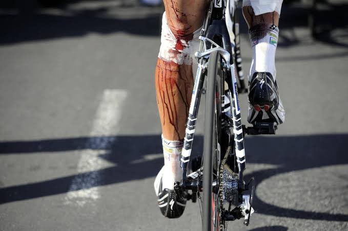 源田の負傷が話題ですけど、自転車選手は怪我しても走り続けます。タイラー・ハミルトンは2003年ツール第1ステージで鎖骨を