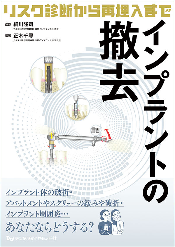 【裁断済】インプラントの撤去リスク診断から再埋入まで インプラントの撤去 リスク診断から再埋入まで』を発売しました