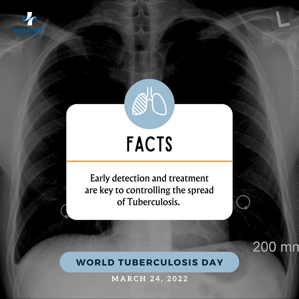 sehat_my's tweet photo. #tuberculosis #covid #tb #tbc #hiv #endtb #cancer #aids #coronavirus #hivaidsawareness #worldtuberculosisday #diabetes #hivawareness #health #worldtbday #stroke #arv #nostigmahiv #hivjakarta #kds #aidsawareness #puskesmas #healthcare #hivtest #testhivgratis #kondom #konselinghiv https://t.co/PndiTfW5dG