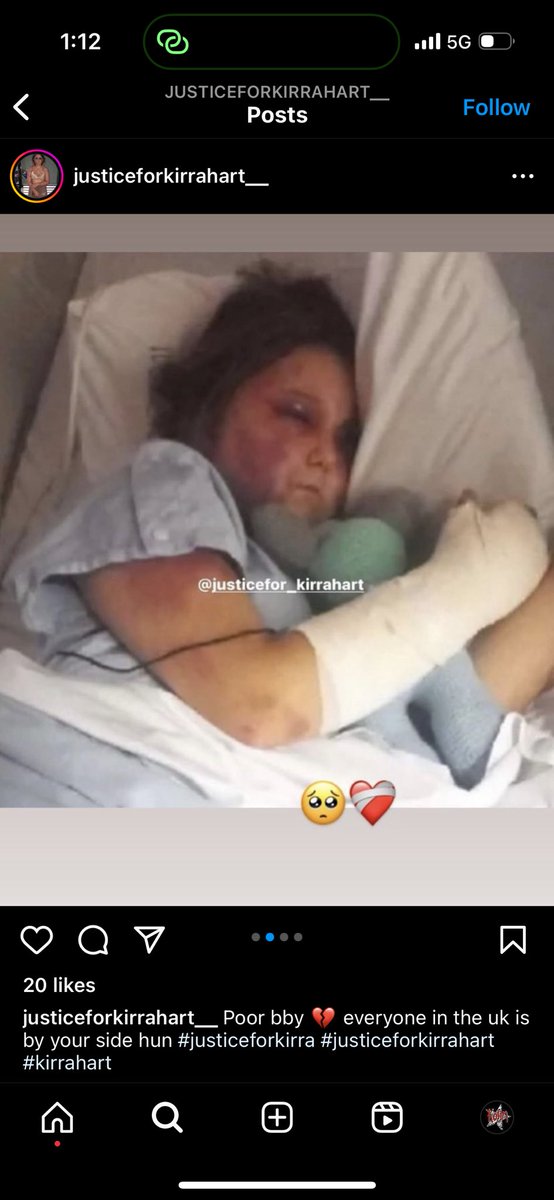 cert1fiedmunch's tweet photo. #justiceforkirrahart #justiceforkirra poor baby I can’t believe what they did to these gorgeous sweet girl for 4 hours 💔 https://t.co/5lYxqkJB1f