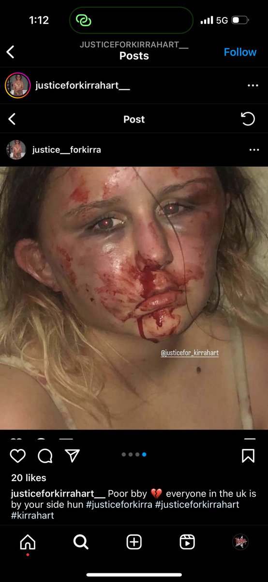 cert1fiedmunch's tweet photo. #justiceforkirrahart #justiceforkirra poor baby I can’t believe what they did to these gorgeous sweet girl for 4 hours 💔 https://t.co/5lYxqkJB1f