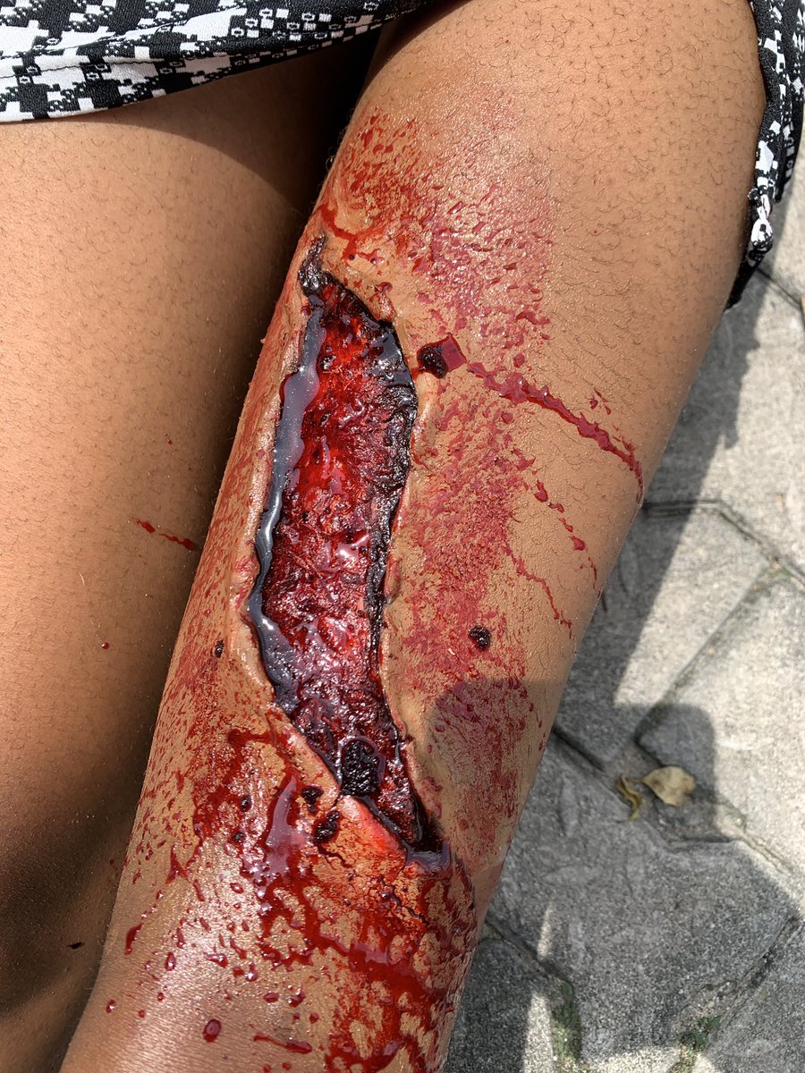 oby_kinika's tweet photo. I made the Blood, Makeup and Prosthetic 🤲🏽, I did amazingly good 🤲🏽❤️ https://t.co/nQlvJyHw9K
