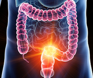 BjsOpen's tweet image. As it is #ColorectalCancerAwarenessMonth, our publisher @OUPMedicine is curating an ongoing collection of @BJSurgery &amp;amp; @BjsOpen articles featuring recent advances in the diagnosis and treatment of #CRC! #ECCAM2023 #StepUp4CRC 
Check it out -&amp;gt;