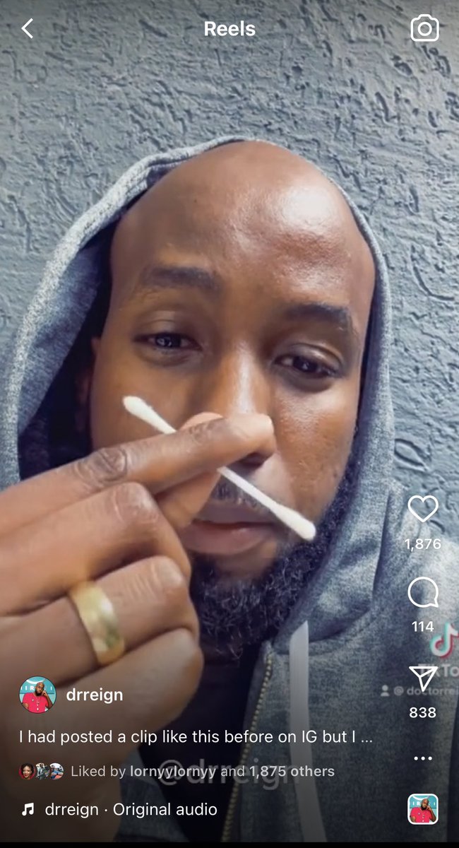 DoctorReign's tweet image. Africans! Parents and caregivers, please stop using these things called ear buds to clean your ears and most importantly your children’s ears. The brown stuff that looks like dirt “uchafu” isn’t dirt but actually natural ear wax called cerumen. The ear cleans itself 🧵