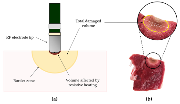 Sensors_MDPI's tweet photo. #highlycitedpaper
Techniques for Temperature Monitoring of Myocardial Tissue Undergoing Radiofrequency Ablation Treatments: An Overview
https://t.co/i0Kyt9I7vd
@CampusBioMedico
#temperaturemeasurements #FBGsensors #infraredthermometry #magneticresonance #ultrasoundthermometry https://t.co/e8CThYe9Pd