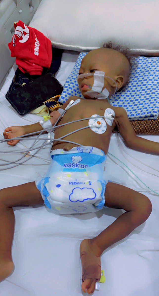 BUduekwe's tweet image. This is Kamsiyochukwu my Nephew he is 10months old diagnosed of THREE HOLES IN HEART Last year now he needs urgent Surgery pls help us save his life 🙏🙏🙏🙏 #helpussavekamsi