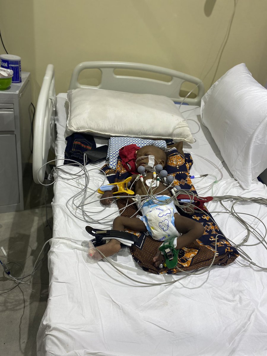 BUduekwe's tweet image. This is Kamsiyochukwu my Nephew he is 10months old diagnosed of THREE HOLES IN HEART Last year now he needs urgent Surgery pls help us save his life 🙏🙏🙏🙏 #helpussavekamsi