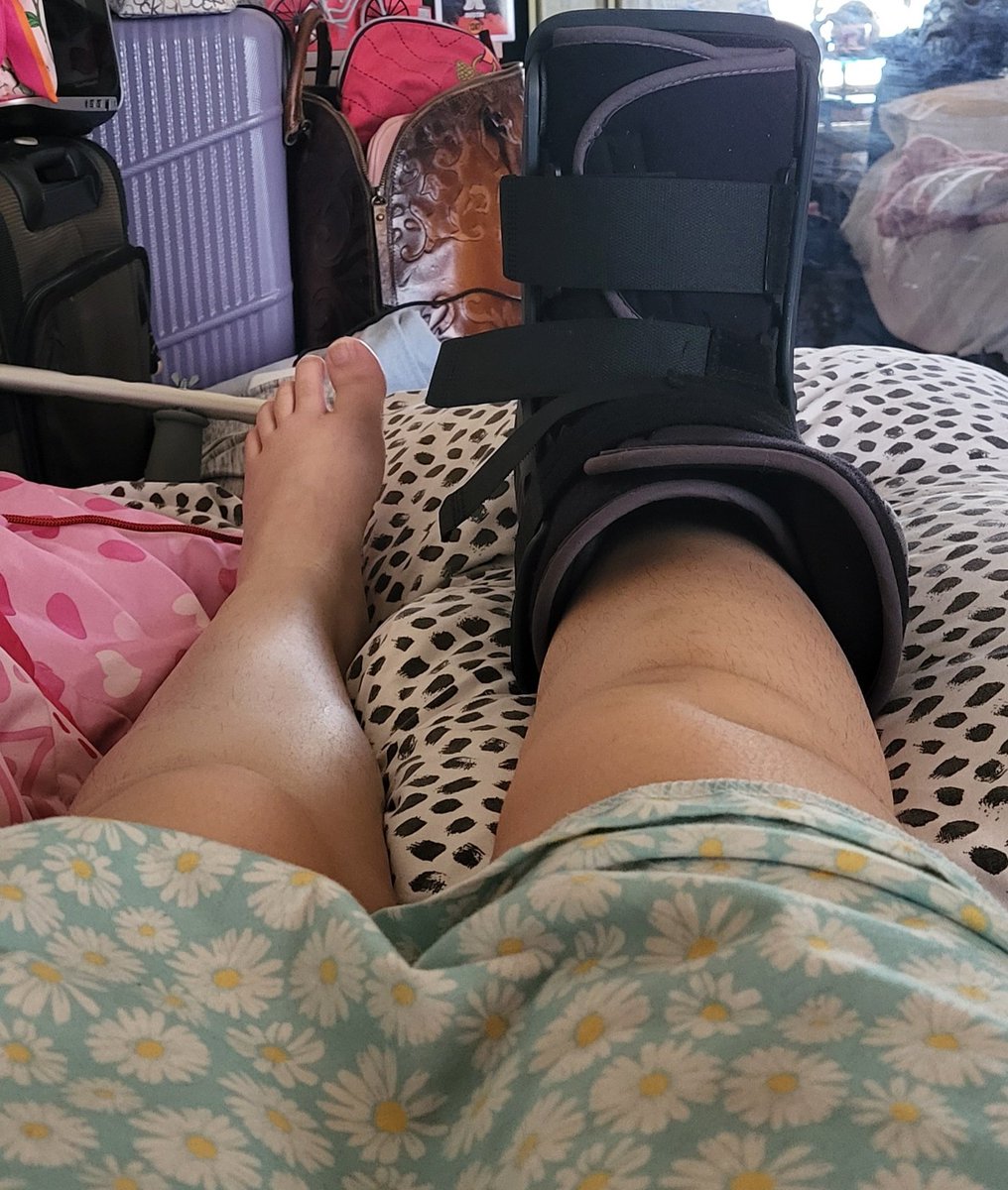 CurvyCurlyQueen's tweet photo. Can't wait to get this dang boot of my foot https://t.co/3bj3Ug4uPb