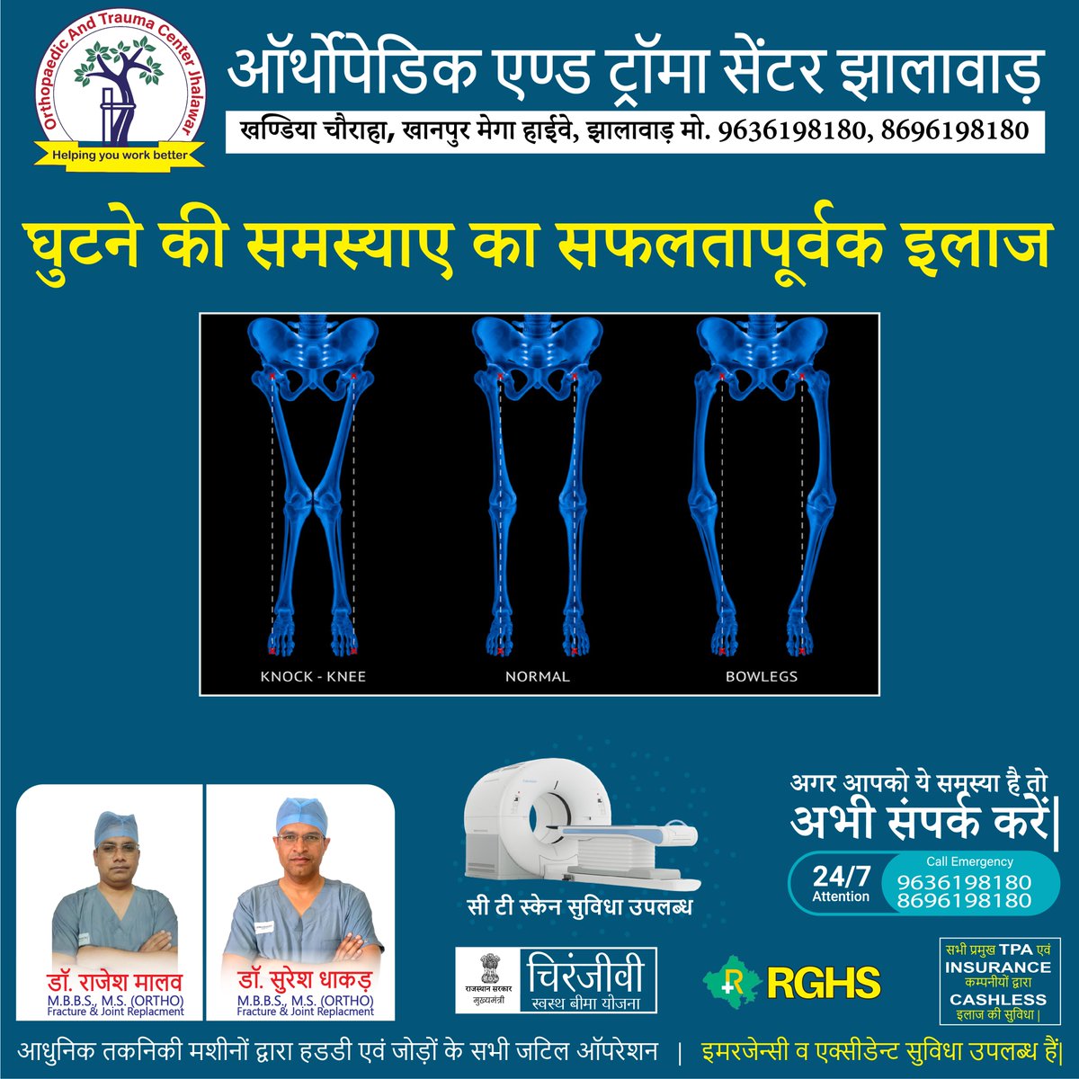 OrthoTraumaCntr's tweet image. घुटने की समस्याए का सफलतापूर्वक इलाज |
अगर आपको ये समस्या है तो अभी संपर्क करें|
 "ऑर्थोपेडिक एण्ड ट्रॉमा सेंटर झालावाड़"
#OrthopaedicTraumaCenterJhalawar 
#bonesurgery #hipsurgery  #kneesurgery #ctscan #hippain #KneePainGone  #hipreplacementsurgery #hipreplacementsurgeon #ortho