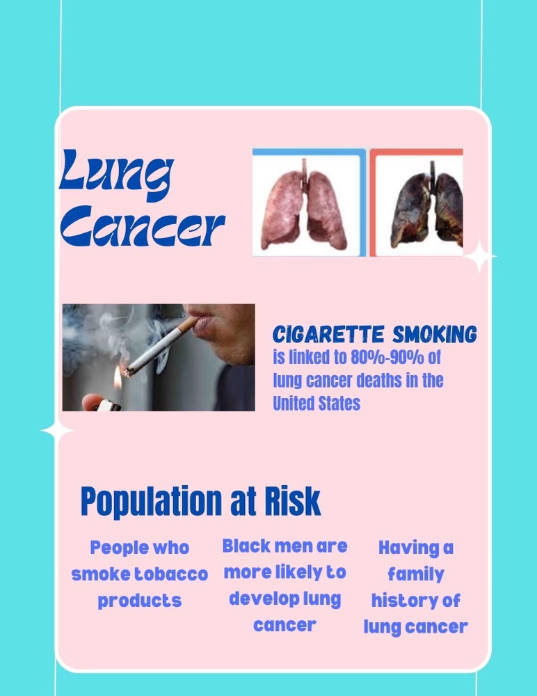 mtsu_relay's tweet photo. Who is at risk for Lung Cancer? https://t.co/8y4TBQ9HH4