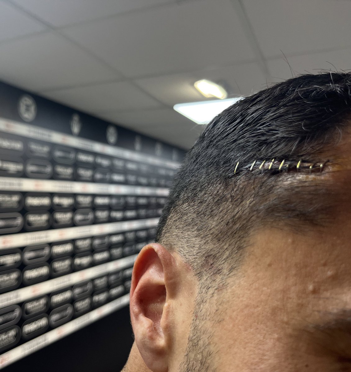 CDCastellon's tweet photo. Marcas de guerra 💣💥

Marcas de un capitán 🤕⚽️

Así ha jugado @davidcubillas el descuento del #CastellónAlcoyano para ayudar al equipo a conseguir los 3️⃣ puntos ⚔️

#PPO100👂 https://t.co/JfTcWDpAlL