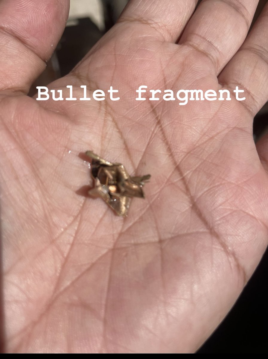 Shackattack210's tweet image. Last week I was victim of a random shooting &amp;amp; the #Yeti stopped the bullet. It keeps drinks cold &amp;amp; saves lives. @YETICoolers @News4SA @KABBFOX29 @ksatnews @KENS5 #SanAntonio Love my Yeti but it’s no longer any good.