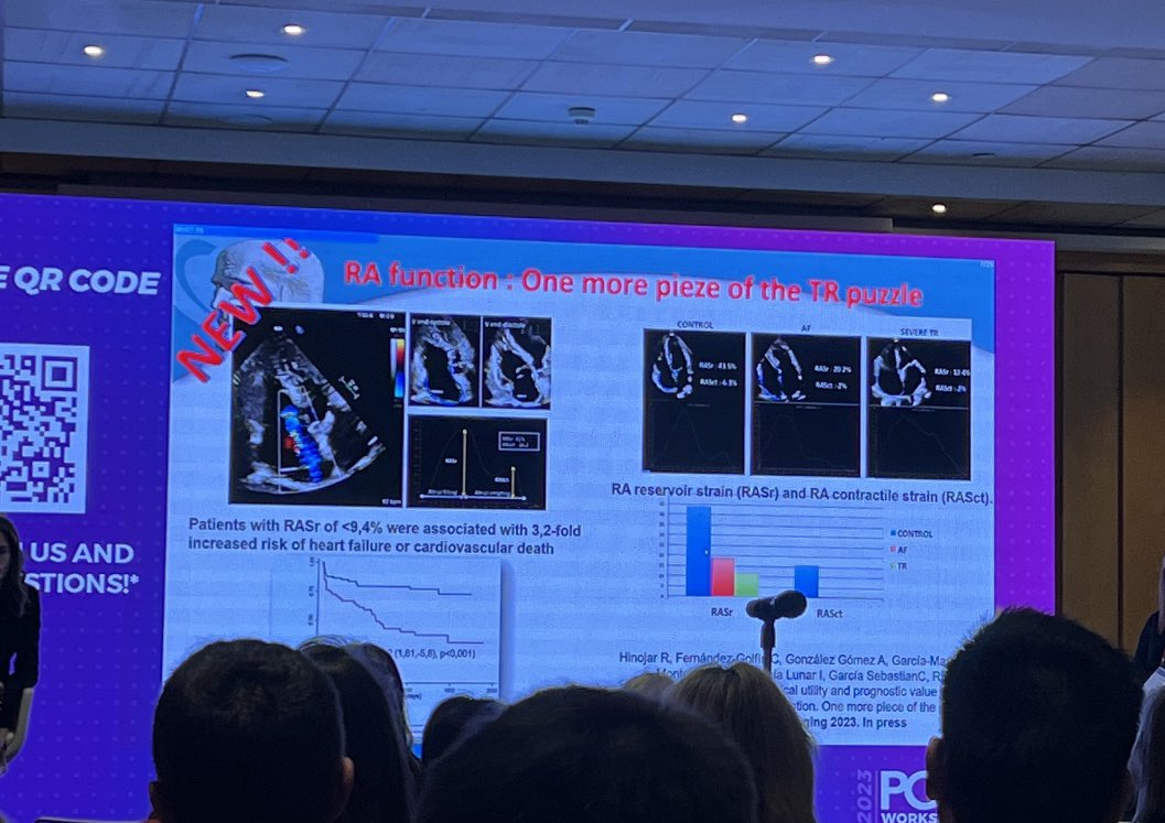 Excellent new insights of tricuspid valves #PCRMadrid #PCRImaging <a href="/PCRonline/">PCRonline 🫀</a> <a href="/NAjmoneMarsan/">Nina Ajmone Marsan</a> @MadalinaGarbi
 Teamwork is the key to success