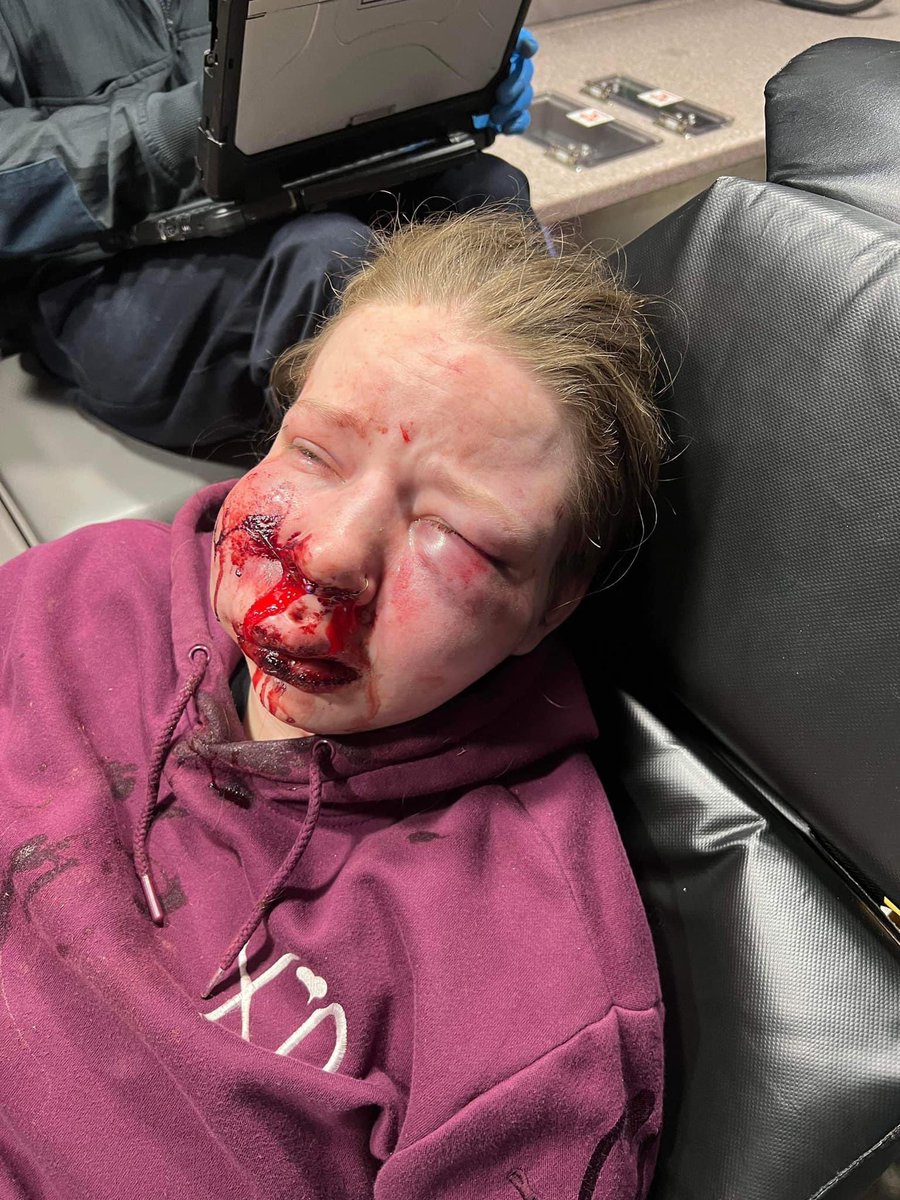 I was a victim to a hate crime last night. I thought this girl outside of the bar was my Uber and she acted as if she was then her friends all piled in the car and they proceeded to take me home. When we arrived, they pulled me out of the car and started stomping and punching my