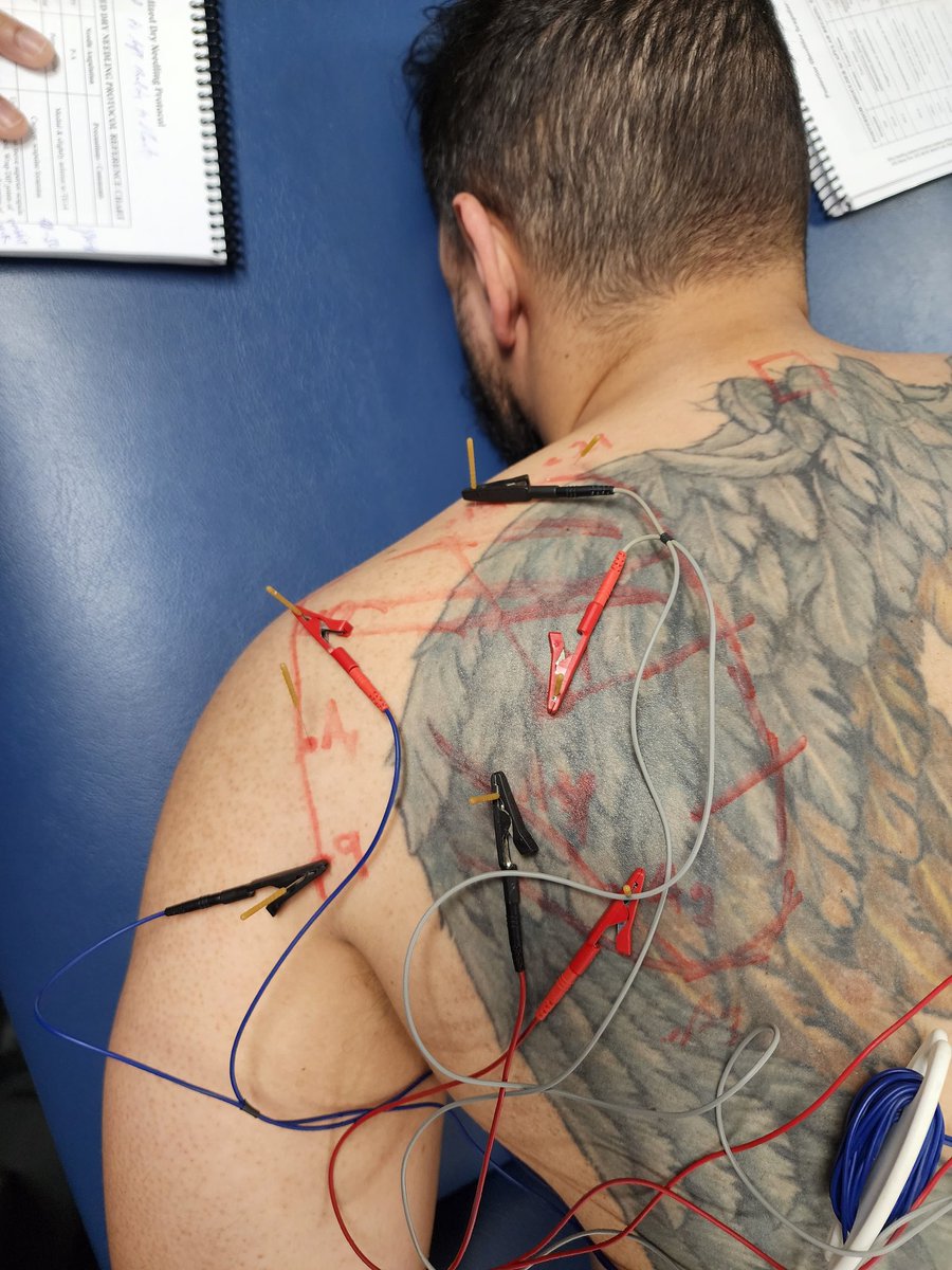 28 PTs and ATC in NJ have begun their journey towards Cert. DN, and better patient outcomes. <a href="/DrDunning/">James Dunning PhD, DPT, MSc</a> @caseyPT23 <a href="/BenjaminEnglan5/">Dr. Benjamin England, PT, DPT, FAAOMPT</a> #AAMT #EBP