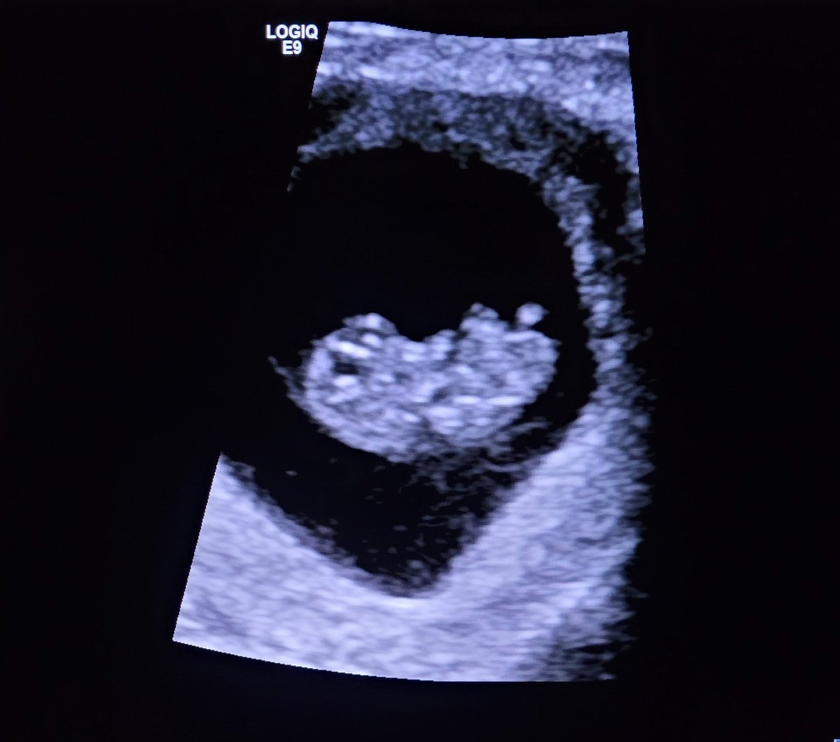 May the force be with us! Still can't believe I'm going to be a dad! <a href="/serenitydreams/">Jessica Sudsbear</a>