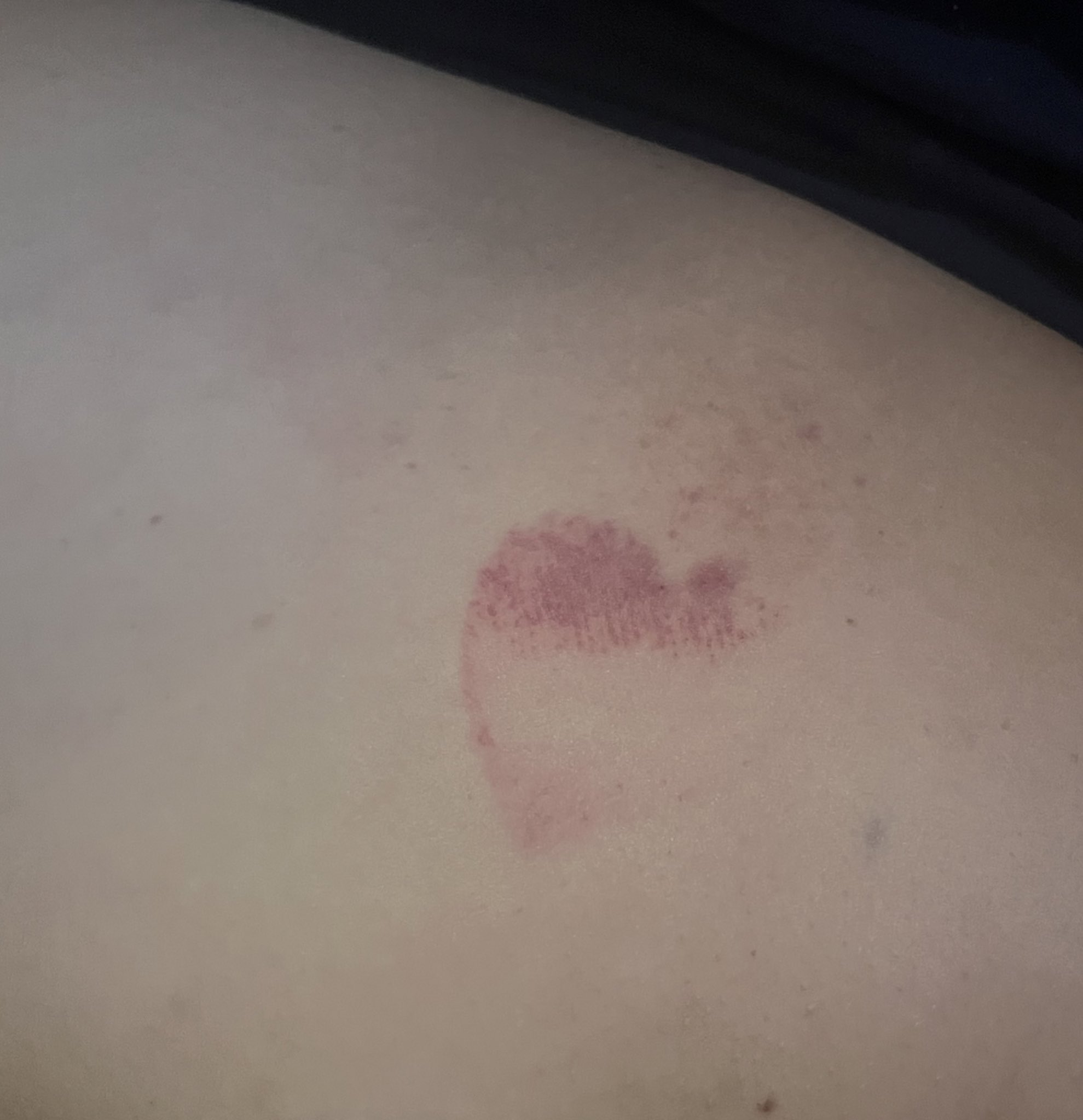and in return I kicked him in the balls (consensually, for his first time, eyes lit up); I’m fun at parties https://t.co/TfpTvCK1t3