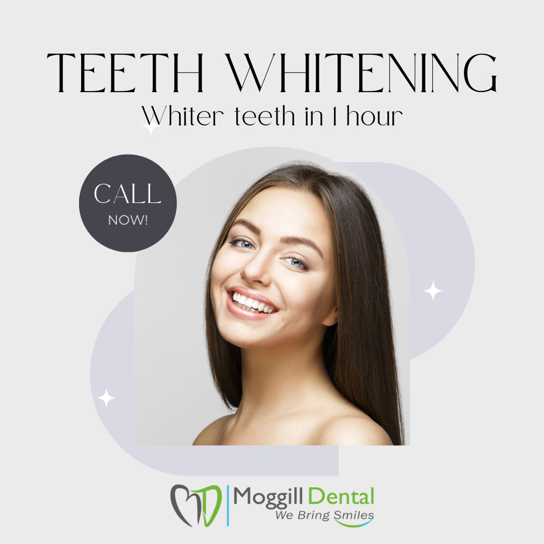 Teeth whitening is one of the best and most effective ways to lighten the colour of your teeth without removing any of the tooth surface. 😊 #loveyourteeth #smiles😊 #smilesforlife #healthysmiles #dental #dentist #moggill #australia
