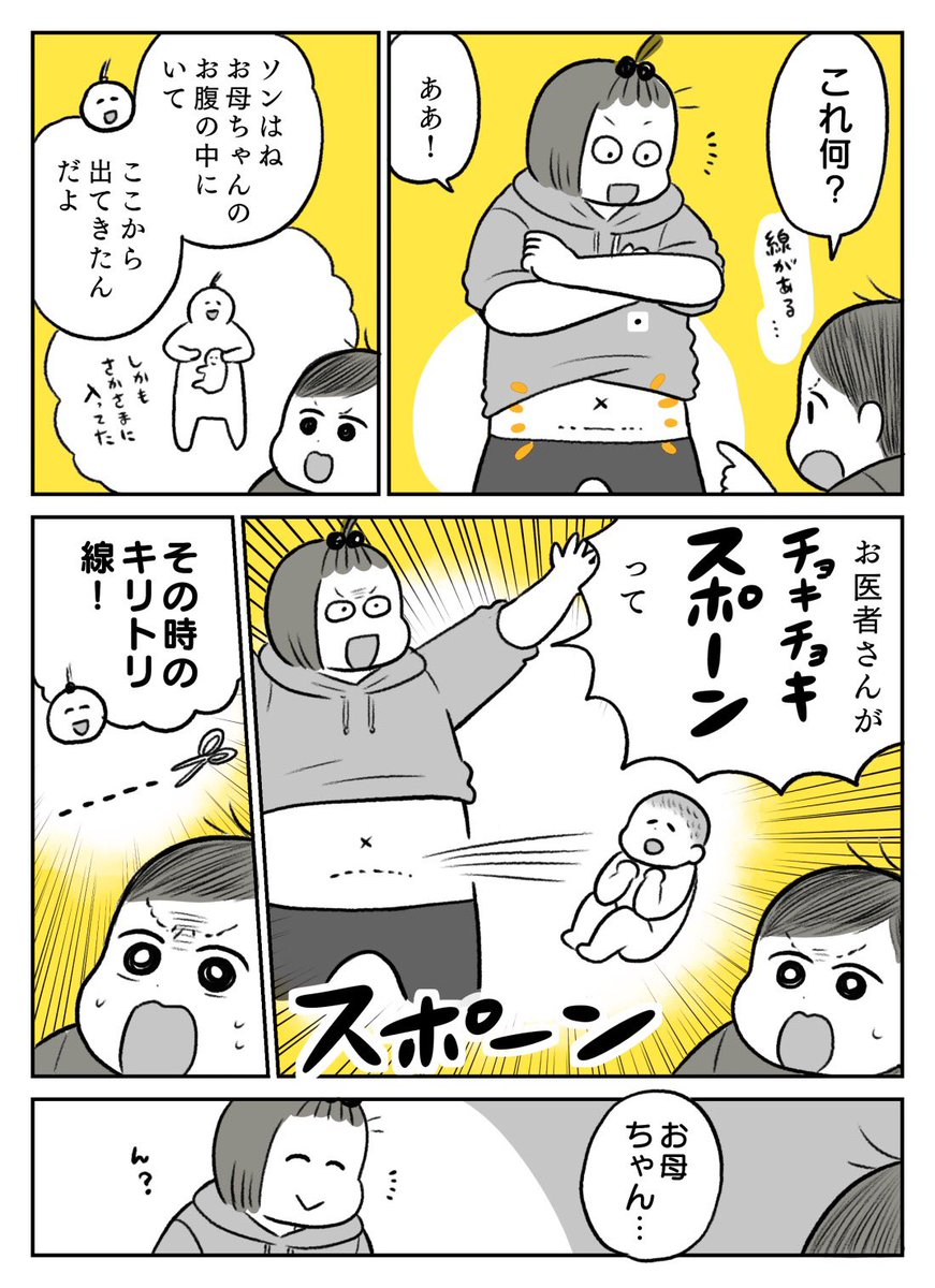 帝王切開よかった探し!① 