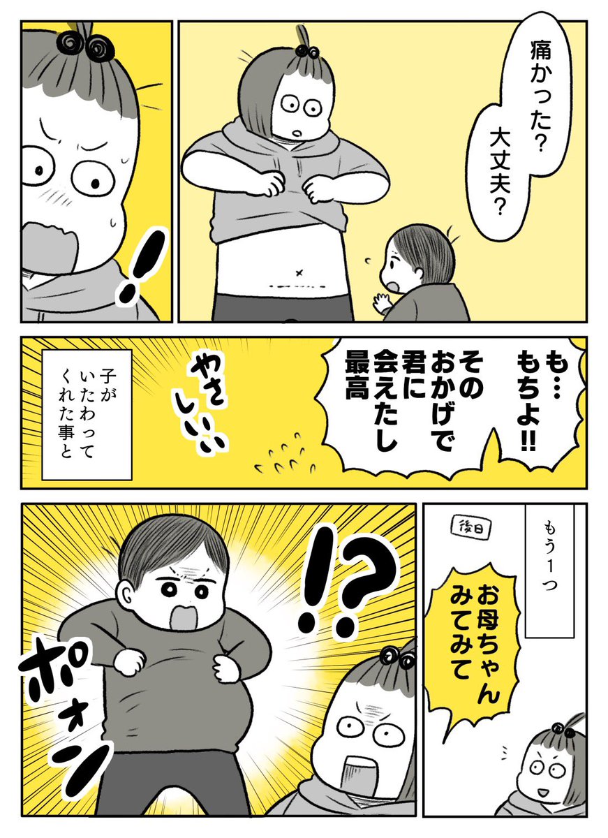 帝王切開よかった探し!① 