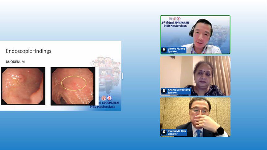 Another successful educational effort by APPSPGHAN virtually in Manila 🇵🇭 to shore up awareness of #paediatric IBD in Asia 🇸🇬 🇰🇷 🇮🇳 #ibd #appspghan . The second masterclass and many more to come ❤️