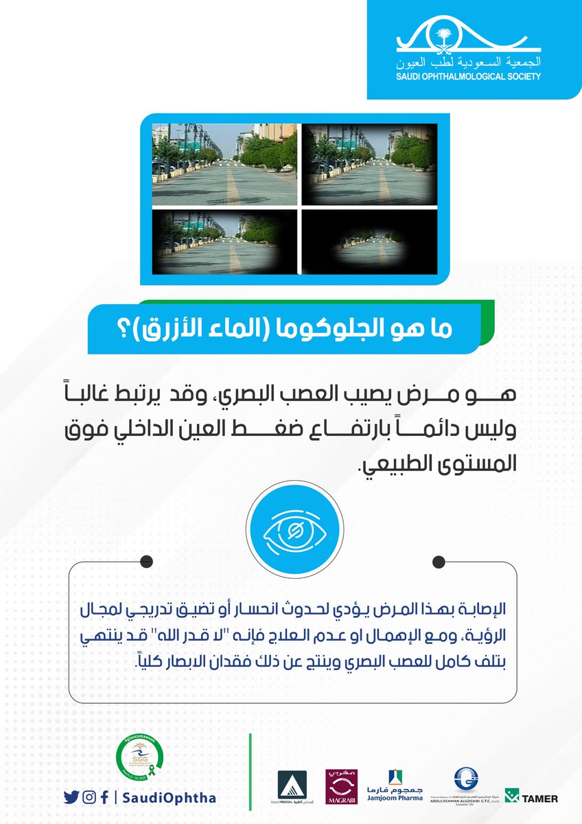 SaudiGlaucoma's tweet photo. ما هو الجلوكوما ؟
وكيف يؤثر على مجال الرؤية ؟

#أسبوع_الجلوكوما_العالمي 
#WorldGlaucomaWeek 
#WorldGlaucomaWeek2023 https://t.co/AYRlre4Qua