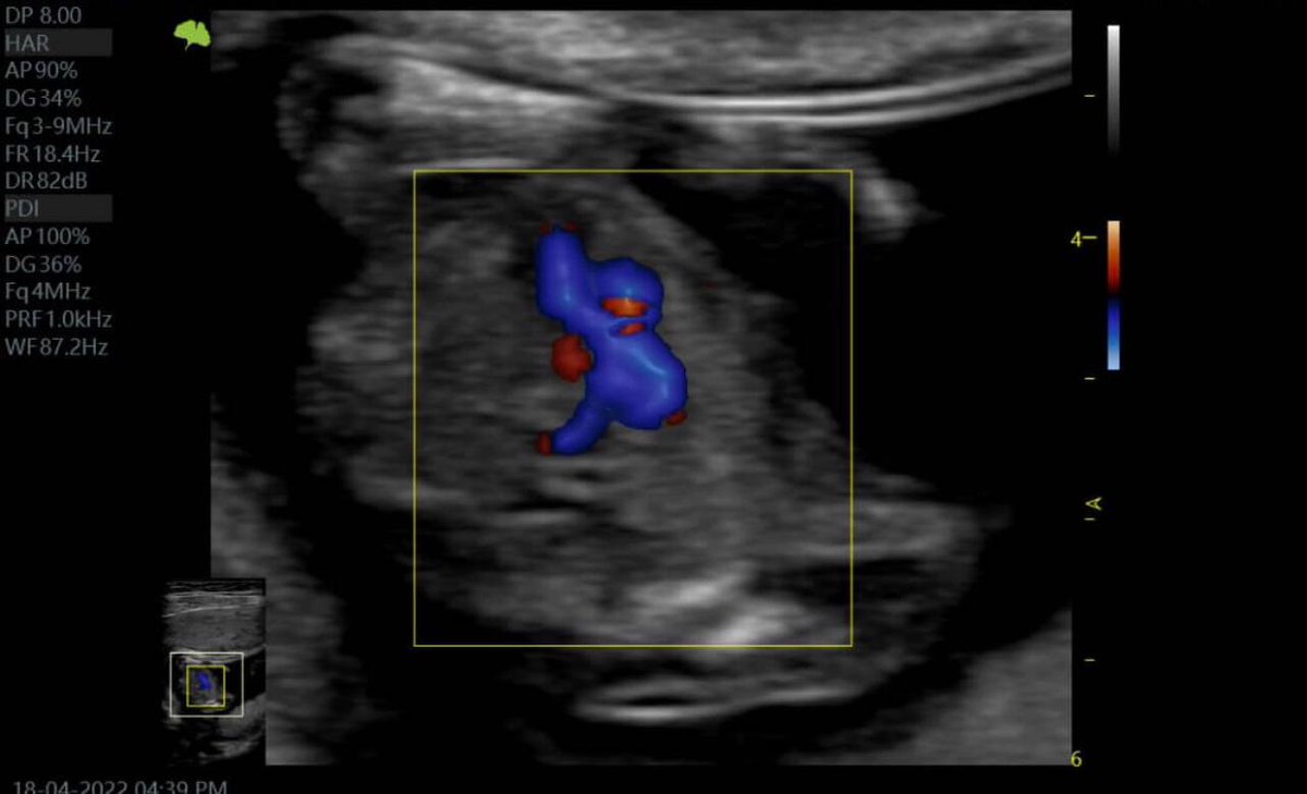 FlashmedSaudi's tweet photo. VINNO G65 … your best choice for fetal imaging
For order and details contact on WhatsApp:
https://t.co/eDyZsKzLx9
#flashmed
#vino
#ultrasound https://t.co/gR2jRgpUDO