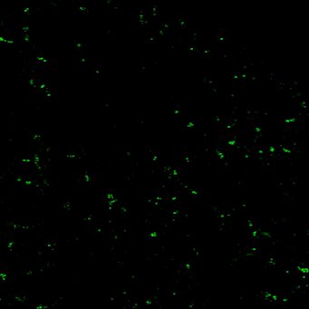 Check-out work by @zeynpokr on the molecular control of E/I balance in neocortex. Including beautiful in vivo synapse marking! biorxiv.org/content/10.110…