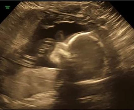 To all my fans that support me my biggest gratitude.   Life isnt worth living unless ur truly living