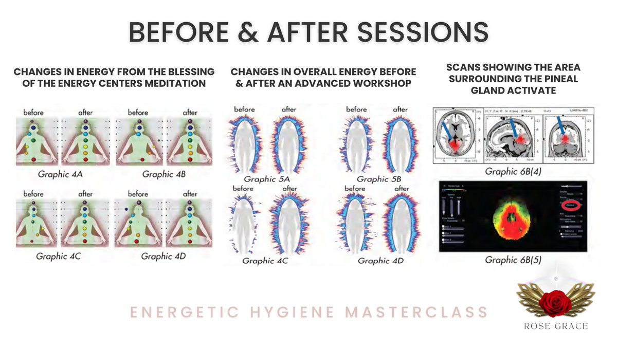 AlisonRoseGrace's tweet photo. Learning how to let go,allowing light to enter our lives is not just a spiritual concept but also a scientific one.
#bioenergeticfield #microtubules #biophotons #geneticexpression #pinealgland #serotonin #higherfrequency #emotion #health #immunesystem #chronicdisease #mindbody https://t.co/XOaeWoBYHC