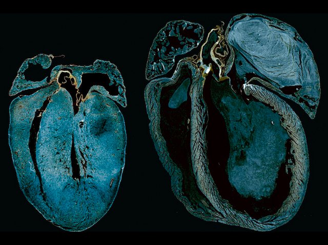 Faulty energy production in #heart cells precedes and may underlie #heartfailure – intervention target. Image &amp; research by Abdalla Ahmed et al <a href="/PaulDelgadoOlgu/">Paul Delgado-Olguin</a> lab <a href="/SickKidsNews/">The Hospital for Sick Children (SickKids)</a> in <a href="/NatureCVR/">Nature Cardiovascular Research</a>. Read more on bpod.mrc.ac.uk/archive/2023/3… with <a href="/MRC_LMS/">MRC Laboratory of Medical Sciences (LMS)</a> and <a href="/rooph/">Ruth Williams</a>