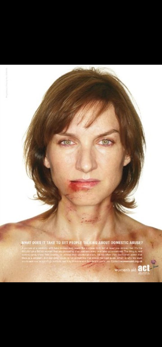 PaulBurkester's tweet image. #FionaBruce so full of herself wife beating mitigator @RefugeCharity @StanleyPJohnson @bbcquestiontime Bruce's position completely UNTENABLE #SackBruce
P.s what's happened to #ConservativePost ?