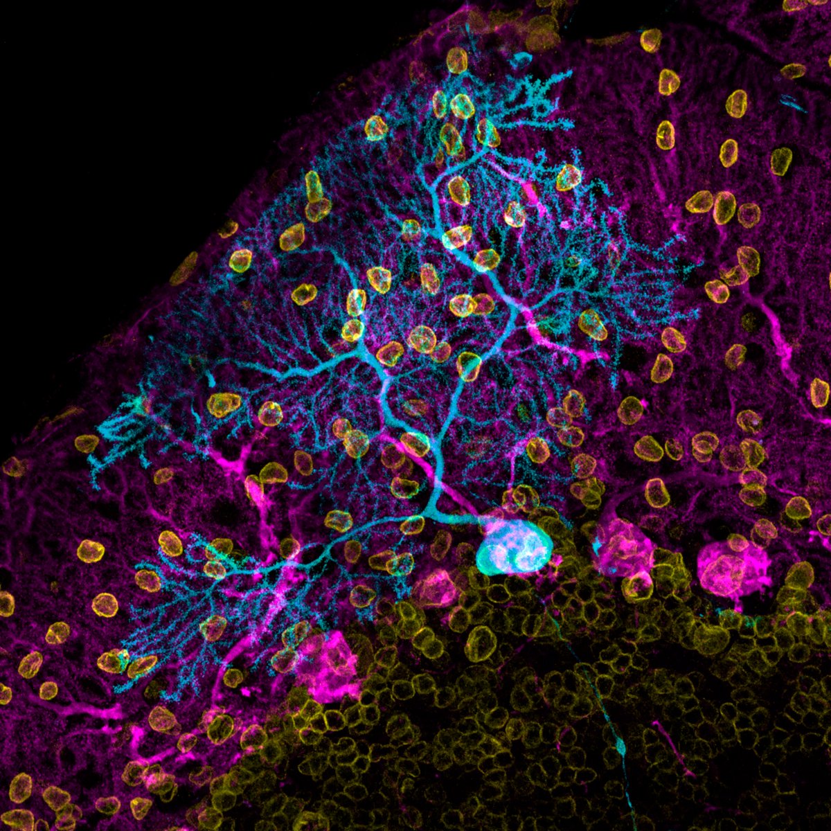 Incyl_Usal's tweet photo. 𝑱𝒖𝒏𝒕𝒐𝒔 𝒆𝒏 𝒍𝒂 𝒔𝒐𝒍𝒆𝒅𝒂𝒅

🎖️Obra de @pablotellez98 es la ganadora del I Certamen de Fotografía Neurocientífica del INCYL🎖️
#SemanadelCerebroINCYL🧠 https://t.co/J92XfT2nzQ