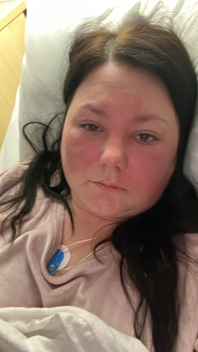 A junior dr saved my life after I had Erysipelas that then led me to have sepsis and go into septic shock with a temp of 42 they acted fast I owe them a debt I could never repay please they work just as hard please give them a pay rise they deserve #juniordrpayrise