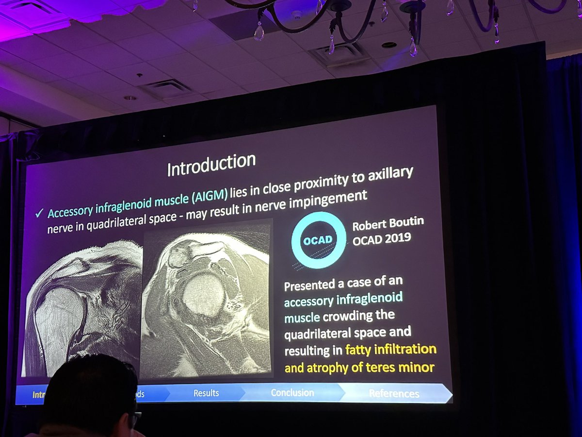 shelbypayne26's tweet photo. Great presentation by Stanford’s Jennifer Padwal on incidence of the accessory infraglenoid muscle in patients with fatty infiltration of the trees minor. Proud to be your colleague! @SSRbone @StanfordMSKRad @StanfordRad #SSR2023 https://t.co/DFQQYTXNAA