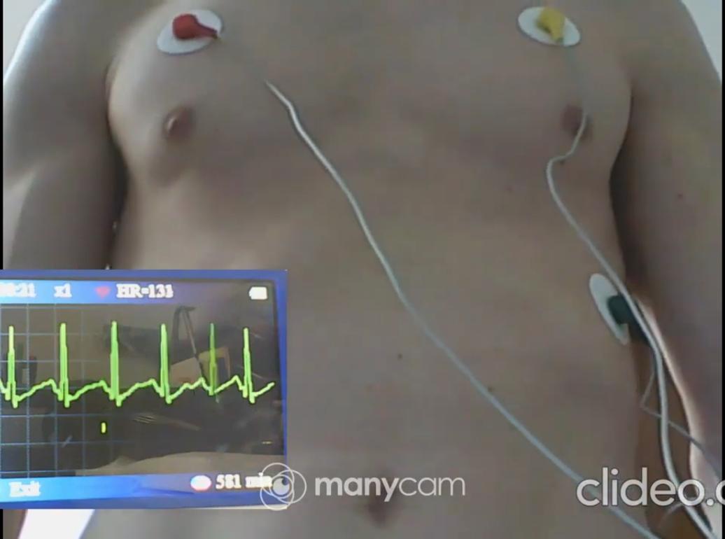 ItalianBoyHB's tweet photo. it has been moved to my new #YouTube channel. Here’s the link https://t.co/ur8Xzv8HAm - #heartbeat #auscultation #cardiophile #stethoscope #hbfetish #maleheartbeat https://t.co/I44AhfB5bQ