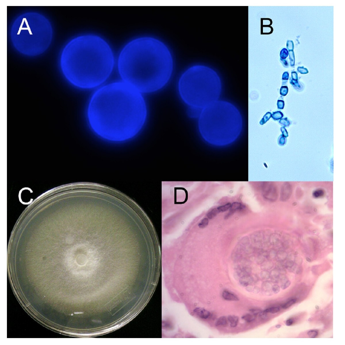 ASM on Twitter: "#MicrobiologyMonday: Diagnostics for ...