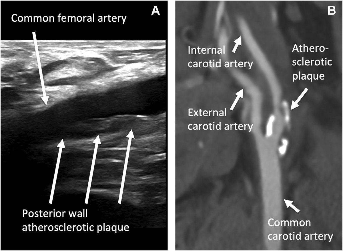 All of our Editor's Choice articles at #BJAEducation are free to access, here is the collection:

bjaed.org/editors-choice

Sustainability, transgender and gender diverse considerations, nerve blocks, pharmacology, imaging... and much more!

#anaesthesia #periop #criticalcare