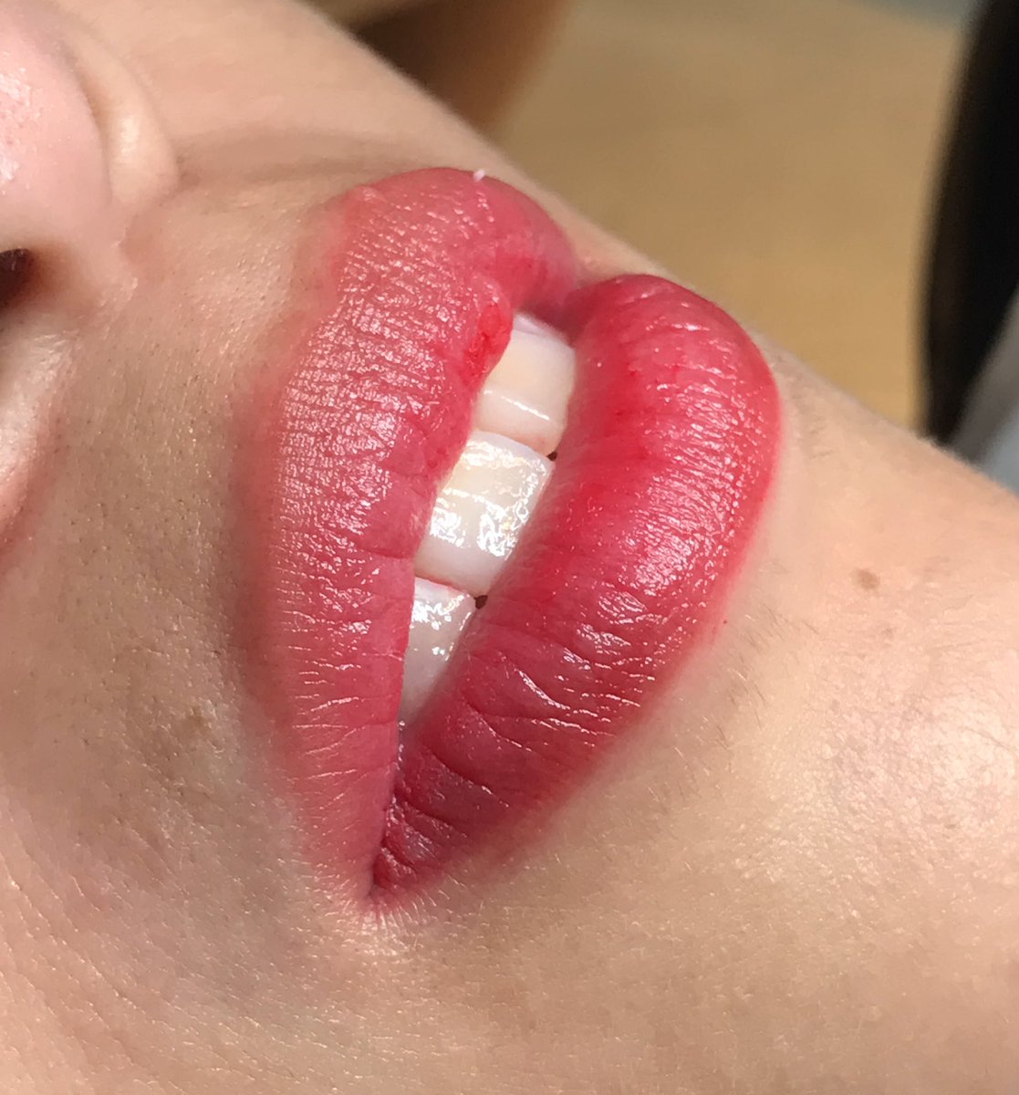 BethaniaSamudi1's tweet photo. Sorteo .!!
Regalo un Gif Cart con  50 % descuento servicio de Microlips
Incluye retoque a los 30 días 💋
Solo tienes que darle RT y mencionar a una amiga/o   Y ya participas !!!🥳
Sorteo 28/03 👄 https://t.co/NBk7L5AzZw
