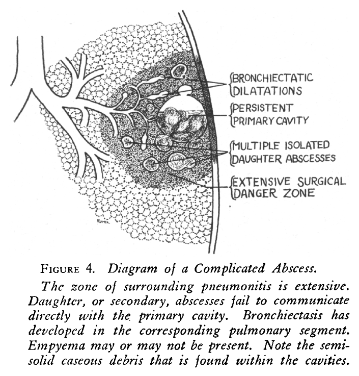 NEJM on Twitter "From the NEJM Archive Factors in the Reduction of