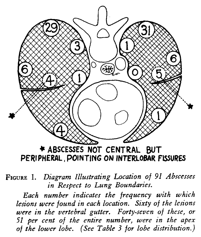NEJM on Twitter "From the NEJM Archive Factors in the Reduction of