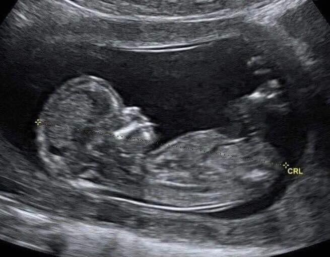 Aqui está uma foto do meu último dia sem stress.
Bons tempos.