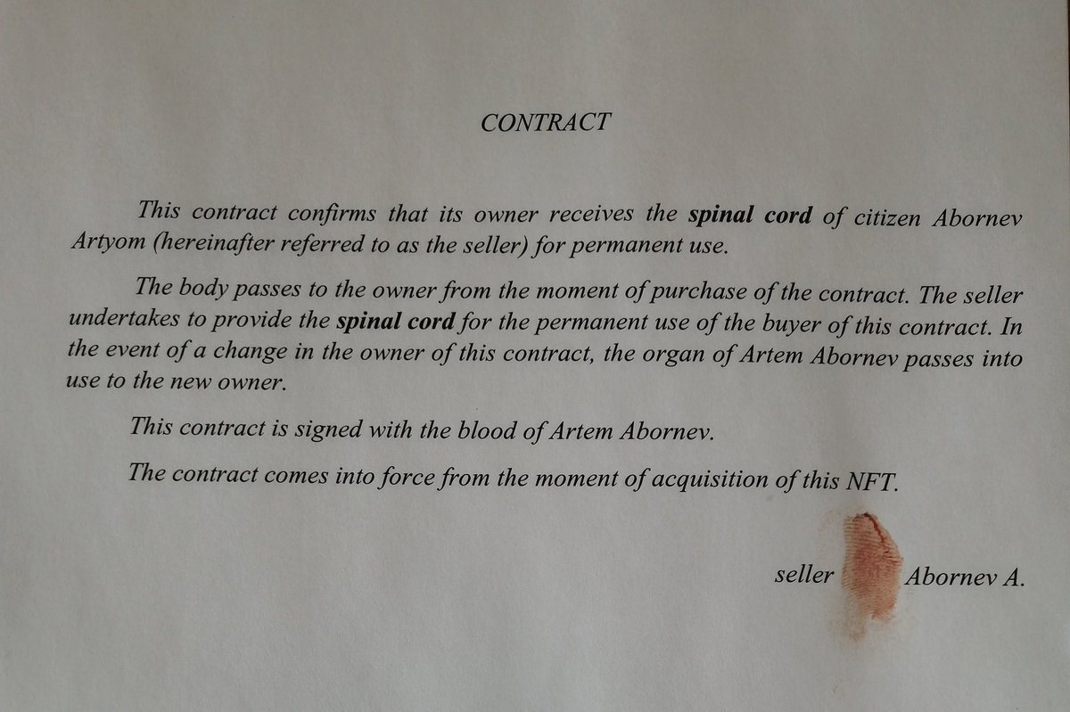 aadedof's tweet photo. 🔸NFT contract on my spinal cord 😱

🔸Signed with my blood🧐

🔸See more on: https://t.co/5D5FeWmzjr

#NFTGiveaways #NFT #NFTCommunity #NFTs #NFTCollection #NFTdrop #opensea #eth #ethereumblockchain https://t.co/BhTYMSX3Wm