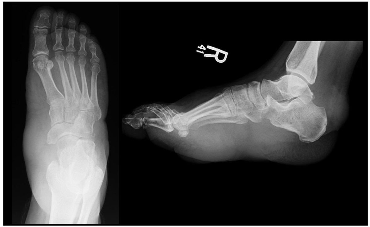 Society of Skeletal Radiology tweet media