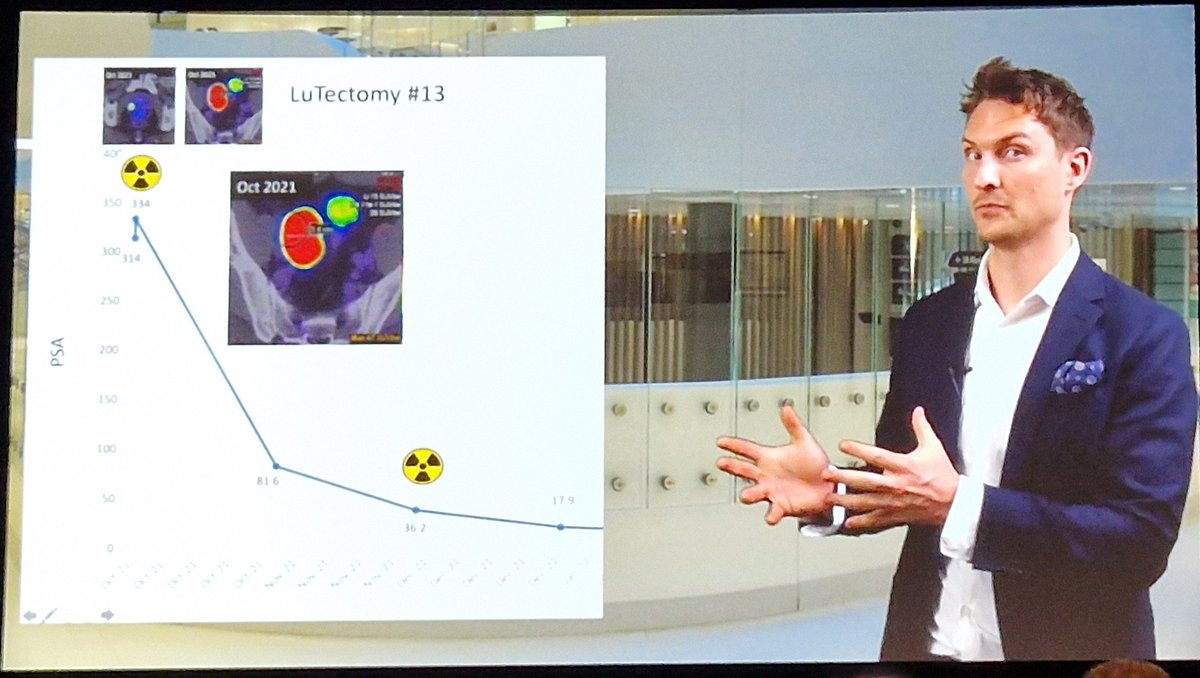 Alastair Lamb (@lambalastair) on Twitter photo <a href="/JonathanSOBrien/">Jonathan O'Brien</a> & <a href="/declangmurphy/">Declan Murphy</a> deliver one of highest quality videos of #EAU23 with slick, professional production values. This is how all videos should be put together! If only rest of our community had skills of this group.
Key message: RP is safe/feasible after #Lutectomy <a href="/JonathanSOBrien/">Jonathan O'Brien</a> & <a href="/declangmurphy/">Declan Murphy</a> deliver one of highest quality videos of #EAU23 with slick, professional production values. This is how all videos should be put together! If only rest of our community had skills of this group.
Key message: RP is safe/feasible after #Lutectomy