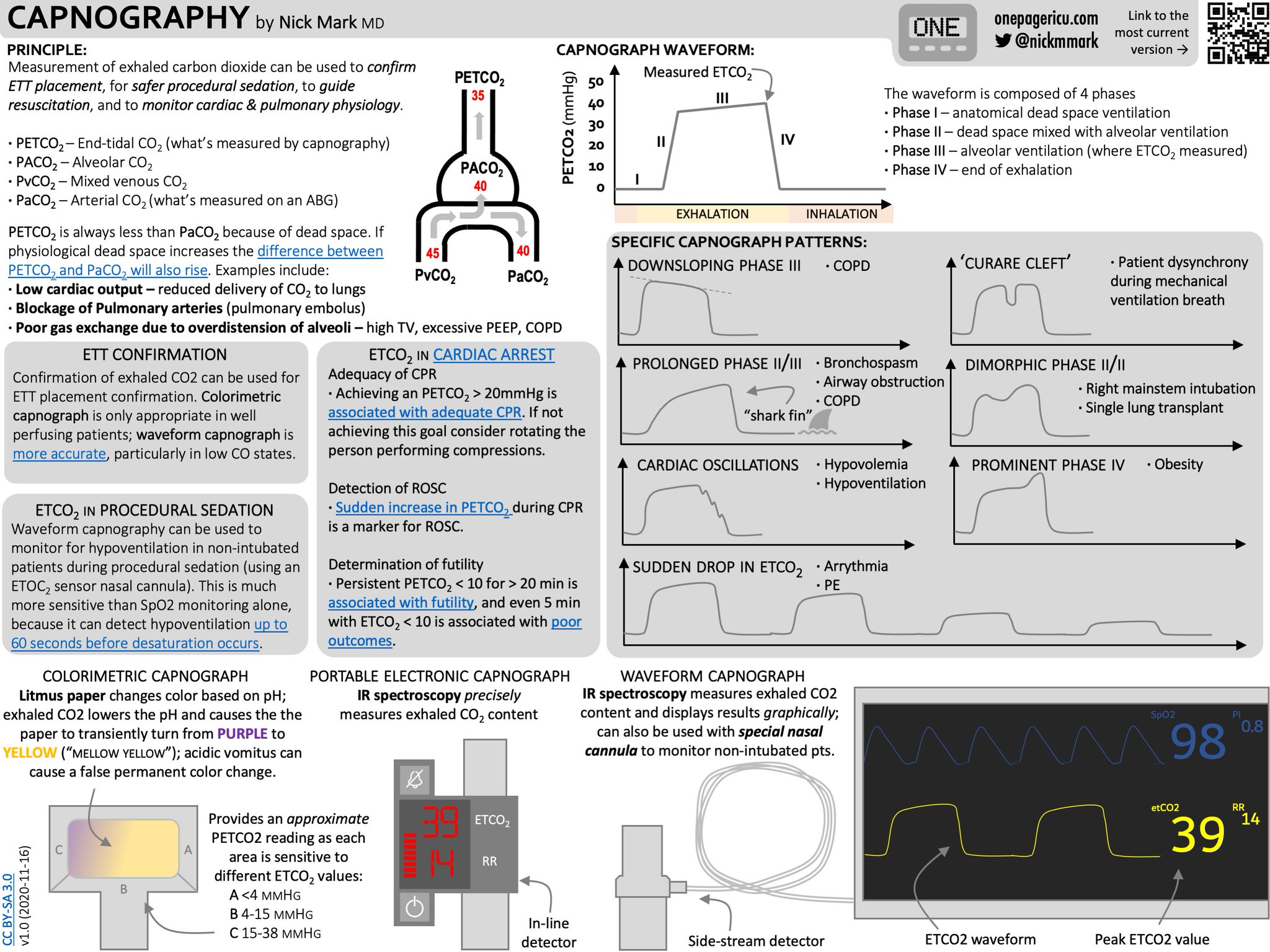 ICU OnePager on Twitter "Here's the ICU OnePager guide to end tidal