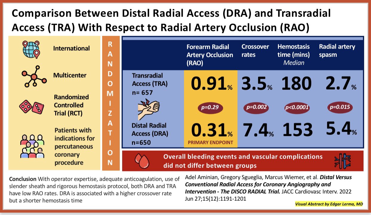 Edgar V. Lerma 🇵🇭 on Twitter "Radial Artery Cardiac Catheterization in