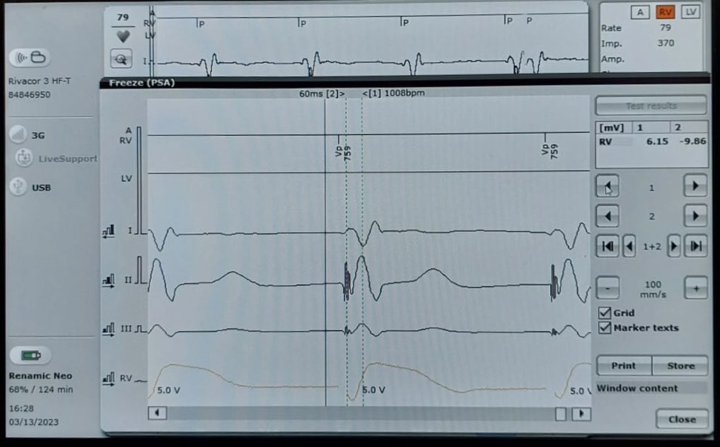 Ugur Canpolat tweet media