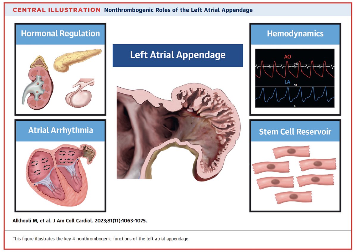 7 months ago I wrote a tweetorial about the non thrombotic functions of the LAA. Great insights from many people followed. @drpaulfriedman suggested we turn it into a paper. The 📝 was published today. Should have listed #Cardiotwitter as a co-author ;)